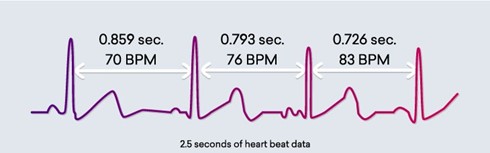 variabilité de la fréquence cardiaque